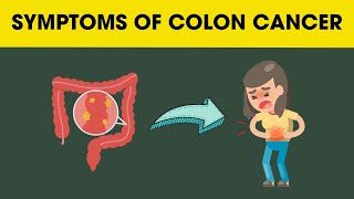 5 Signs and Symptoms of Colon Cancer  Health [upl. by Drummond965]