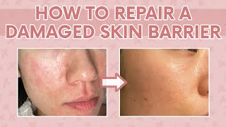 How to Heal a Damaged Skin Barrier 101  Tips to Repair a Damaged Moisture Barrier [upl. by Olraced]