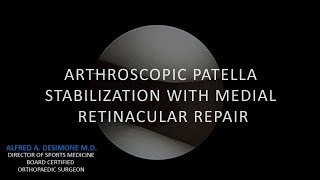 Arthroscopic Patella Stabilization with Medial Retinacular Repair [upl. by Nij]