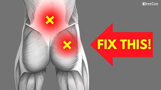 How to Fix Lower Back and Hip Pain FOR GOOD [upl. by Adnyleb121]