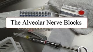 The Alveolar Nerve Blocks [upl. by Lingwood691]