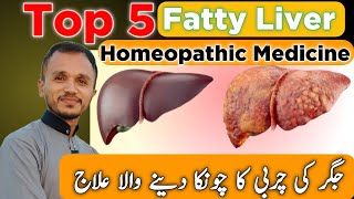 Fatty Liver Treatment  Fatty Liver Homeopathic Medicine  Top 5 Homeopathic Medicine [upl. by Raybourne]