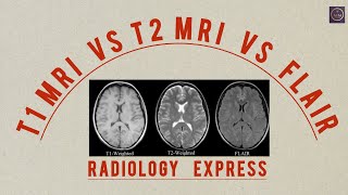 T1 MRI VS T2 MRI VS FLAIR  RADIOLOGY HOW TO IDENTIFY [upl. by Lachance430]