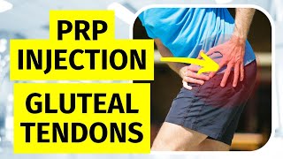 PRP Injection for Trochanteric Bursitis amp Gluteal Tendinopathy [upl. by Brandtr]