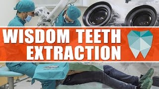 Wisdom teeth extraction with surgery microscope  DENTAL NETWORK IN LEEDS [upl. by Nivahb965]