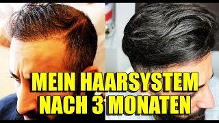 MEIN HAARSYSTEM NACH 3 MONATEN  VOLLE HAARE OHNE OP  BARTMANN [upl. by Billi445]