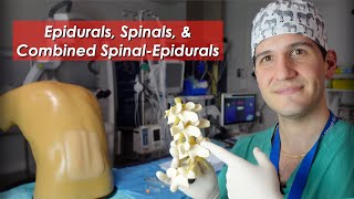 Epidural spinal and combined spinalepidural overview [upl. by Amabel]