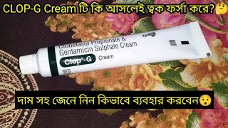 ClopG Cream এর কাজ কিদাম সহ জেনে নিন ব্যবহার করার নিয়ম  ফর্সা হওয়ার ক্রিম  ClopG Cream Review [upl. by Lairea]