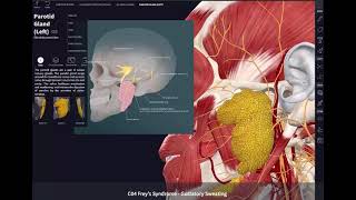 Freys syndrome or Gustatory sweating [upl. by Otilopih]