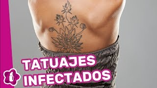 Tatuajes infectados cómo curarlos [upl. by Mariande862]