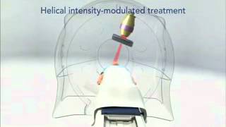 Overview TomoTherapy [upl. by Sam]