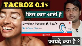 tacroz forte 01 ointment  tacroz ointment 01  use in hindi [upl. by Enilemme]