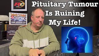 Pituitary Brain Tumour… RADIOTHERAPY [upl. by Pansir90]