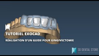 EXOCAD Tutoriel  Comment réaliser des gouttières de gingivectomie via Exocad 3D Dental Store [upl. by Annamarie]