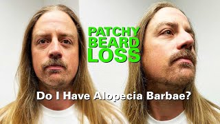 Patchy Beard Loss Do I Have Alopecia Barbae [upl. by Viscardi]