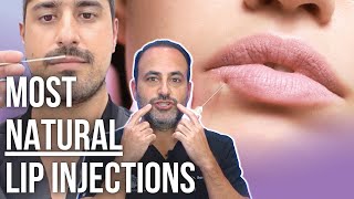 Achieving the Most NaturalLooking Lip Injections  Lesson of the Day [upl. by Hinkel]