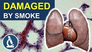 Antismoking Ad Smoking Causes Emphysema Lung Cancer shorts [upl. by Hitt764]