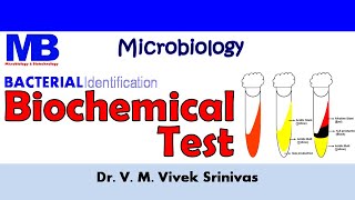 BIOCHEMICAL TEST  Bacterial Identification Technique  Microbiology  Vivek Srinivas Bacteriology [upl. by Valenza]