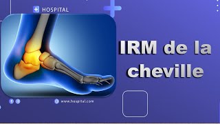 IRM de la cheville Bonne Pratique [upl. by Llib157]