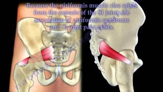 Piriformis syndrome or true sciatica  Everything You Need To Know  Dr Nabil Ebraheim [upl. by Niwred]