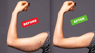 Burn Flabby ARMS FAT 10 Minute Arm Flab Workout  No Equipment Needed [upl. by Dranek]