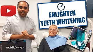 Enlighten Teeth Whitening  Teeth Bleaching  Premium Whitening  Teeth Whitening Demonstration [upl. by Ermengarde]