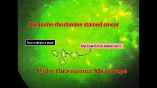 Auramine phenol stain Mycobacterium positveFluorescence microscope [upl. by Norehs]