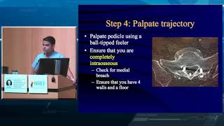 Lumbar Pedicle Screw Placement [upl. by Venterea]