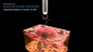 SkinCeuticals Blemish  Age Defense [upl. by Odnomyar]