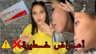 CURACNE تجربتي مع كوراكني ،أعراض و نصائح [upl. by Nibaj]