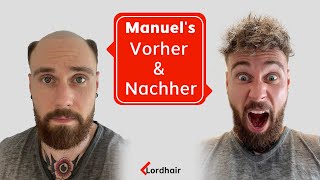 Manuels Transformation  Lordhair Haarsystem für Männer [upl. by Otrebtuc]