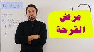 مرض قرحة المعدة والاثنى عشري شرح تفصيلي للاعراض Peptic Ulcer [upl. by Nwahsear]