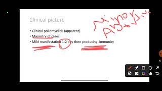 L14 Poliomyelitis COM41 [upl. by Leela880]