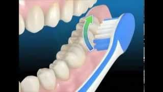 comment se brosser les dents correctement [upl. by Odnalro]