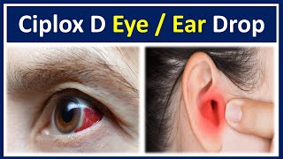 Ciplox d eye ear drops  Ciprofloxacin dexamethasone eye ear drops ciplox d  Ciplox d eye drops [upl. by Lledo]