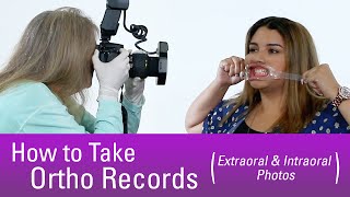 How to Take Orthodontic Records [upl. by Sewell441]