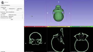 Segmenting Endocranial cavity and making an endocast [upl. by Claudette]