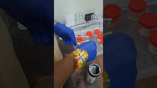 urinetest strip shorts lab video creator shortfeed viral medicalstudent labtechnicians [upl. by Aleb]