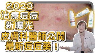 大家都在詢問的新青春痘治療用藥！居然可以避免痘痘變成痘疤？它是如何治療青春痘的？ [upl. by Sillek]