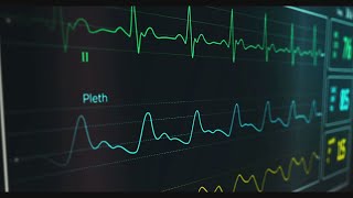 Andria impiantato il primo pacemaker bicamerale senza fili [upl. by Valsimot]