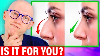 Nose Job Explained by a Surgeon [upl. by Anaicul]