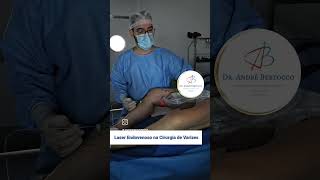 Laser Endovenoso na Cirurgia de Varizes varizes saude laser veias vasinhos skincare estetica [upl. by Roskes506]