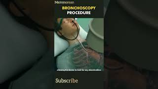 Bronchoscopy procedure3D Animated Bronchoscopy procedure bronchoscopy bronchitis bronchial gnm [upl. by Sleinad]