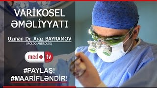 VARIKOSEL EMELIYYATI TAM IZLE  Uzman Dr Araz BAYRAMOV Uroloq Androloq Medplus TV [upl. by Aihsad]