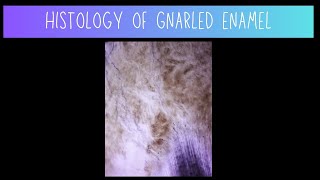 Histology of Gnarled Enamel  Dentistry [upl. by Nesnej31]