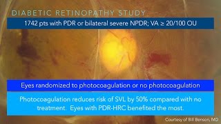 Diabetic Retinopathy [upl. by Ready]