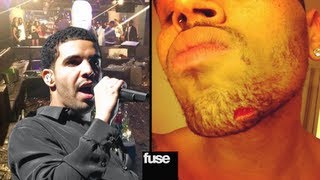 Drake amp Chris Brown Sued for Bar Fight [upl. by Einial]