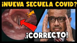 ¡CUIDADO NUEVA SECUELA COVID19 LARINGOESPASMO [upl. by Nosnirb866]