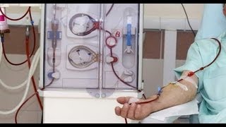 Kidney dialysis All you need to know Dr Deepa Jayaram [upl. by Atalaya107]