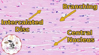 Heart Histology  Valveuable Insights [upl. by Tavia858]